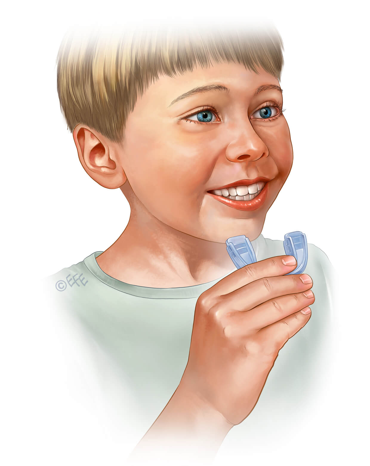 MOJO _ Holding the splint